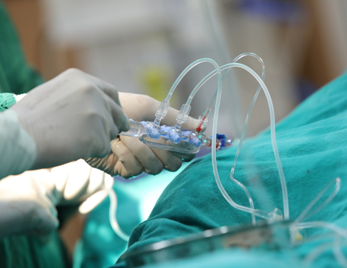 Dr. Salil Garg performing Surgury